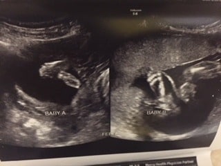 16 weeks pregnant with twins