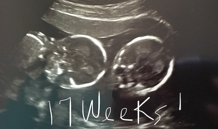 17 weeks pregnant with twins