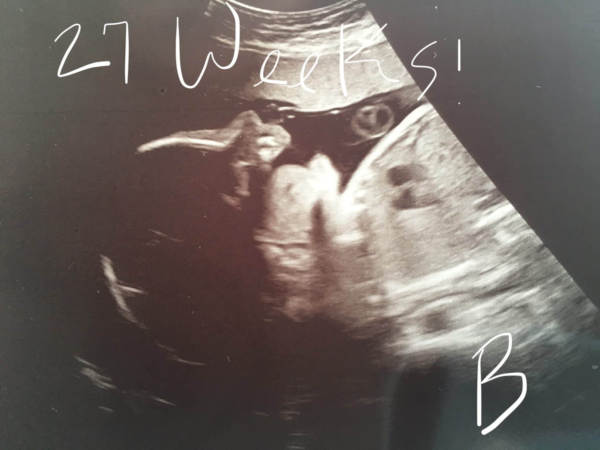 27 weeks pregnant with twins