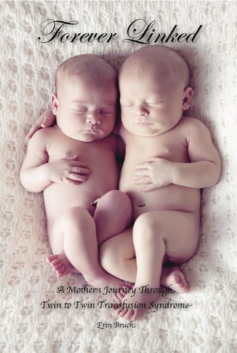 Forever Linked: A Mother's Journey Through Twin to Twin Transfusion Syndrome Forever Linked: A Mother's Journey Through Twin to Twin Transfusion Syndrome
