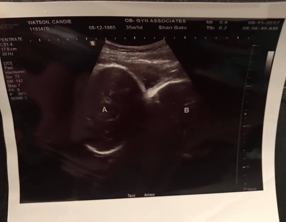 35 weeks pregnant with twins