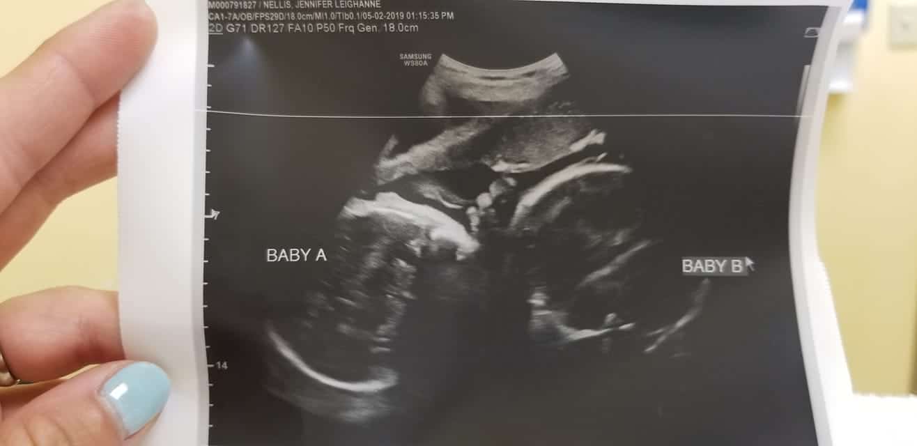 35 weeks pregnant with twins