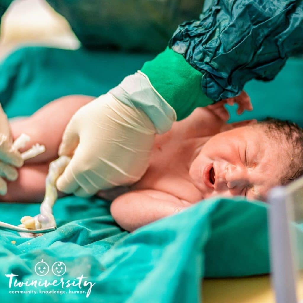 Preparing for Birth: 11 Things to do Before Your Twins’ Delivery Day