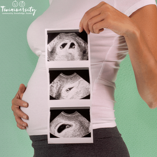 Questions When Expecting Twins